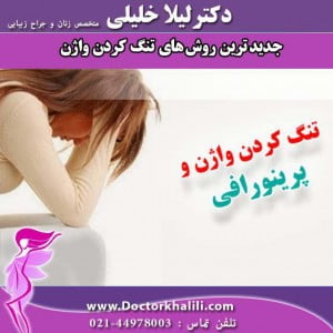 تنگ کردن واژن