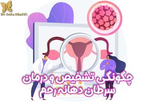سرطان دهانه رحم - دکتر خلیلی