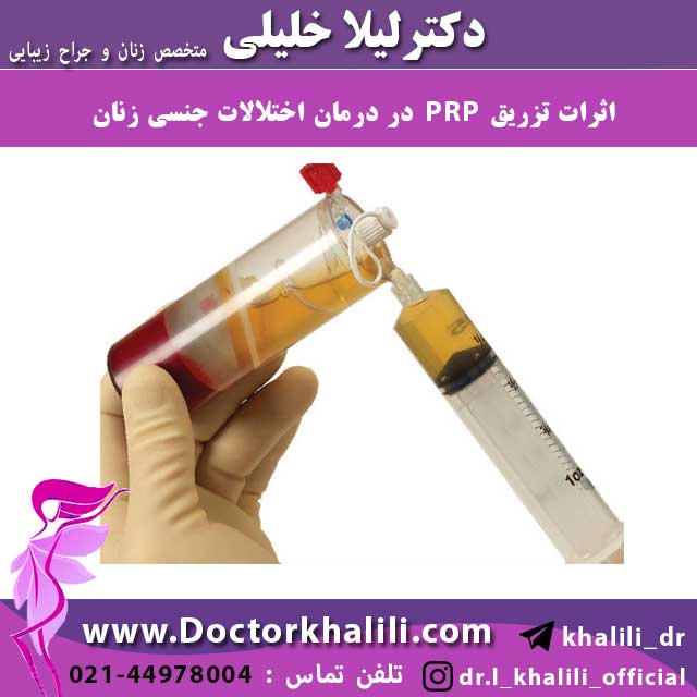 اثرات تزریق prp در درمان اختلالات جنسی